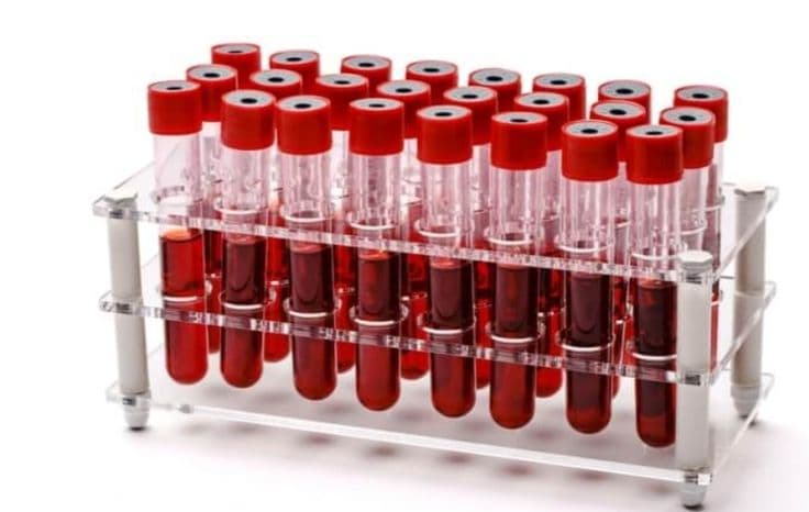 Blood Collection Tubes