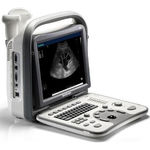 Portable Ultrasound System